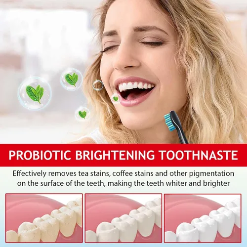 Vista 6 de Paquete de 2 pasta dental blanqueadora probiótica SP-6, fórmula mejorada con 6 probióticos para blanquear los dientes y la salud de las encías