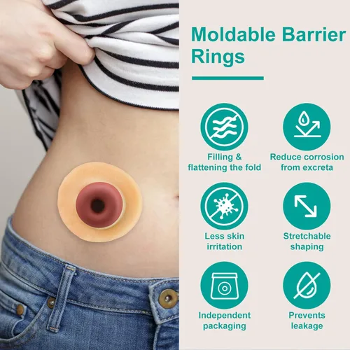 Vista 3 de Anillos de barrera para ostomía - Diámetro exterior 50mm (2"), espesor de 4mm, anillos moldeables para ostomía, anillos extensores de piel