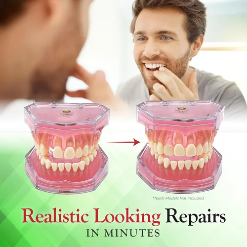 Vista 3 de SmileFix - Reparación dental básica para dientes perdidos o dañados, arregla huecos, dientes perdidos, espacios, dientes rotos, rápido y fácil
