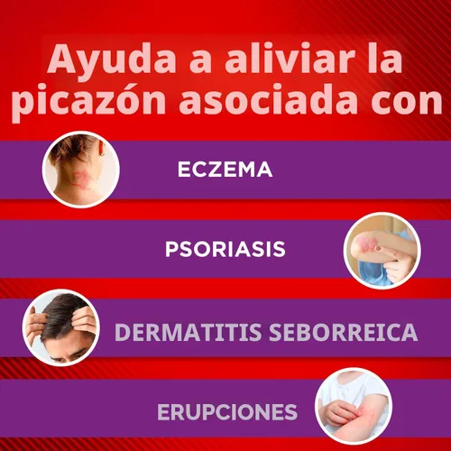 Vista 5 de Cortizone-10 Loción de alivio de picazón de curación intensiva de máxima potencia para eccema, 1% hidrocortisona, de acción rápida, crema