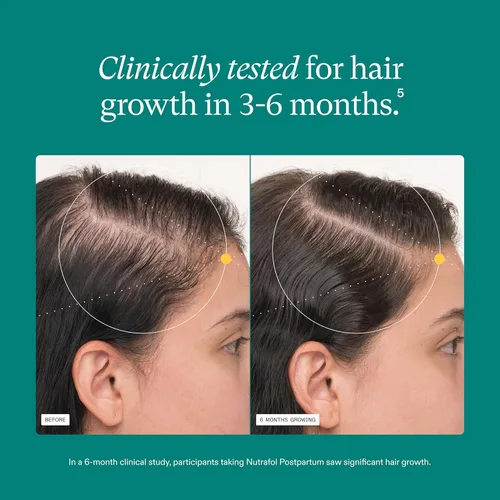 Vista 4 de Nutrafol - Suplementos para el crecimiento del cabello posparto, clínicamente probados para cabello visiblemente más grueso y menos caída, apto