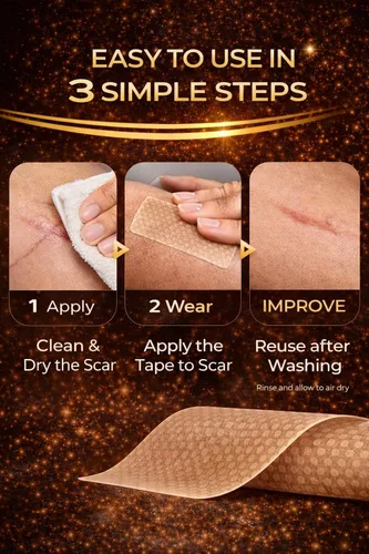 Vista 6 de Cinta de silicona para cicatrices de 1.6 x 80 pulgadas, cinta reutilizable para eliminar cicatrices viejas y nuevas, láminas de silicona prémium