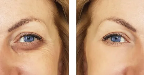 Vista 3 de Péptidos de colágeno Bioactivos de Verisol®, (colágeno natural en polvo), fabricado en Alemania