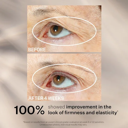 Vista 6 de StriVectin Tighten & Lift Peptight Face Lift Serum with Tightening & Brightening Peptides for Wrinkles