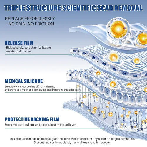 Vista 3 de Hojas de silicona para cicatrices, cinta de silicona para cicatrices (rollo de 1.6 x 158 pulgadas, 13.1 ft), hojas de cicatriz de silicona
