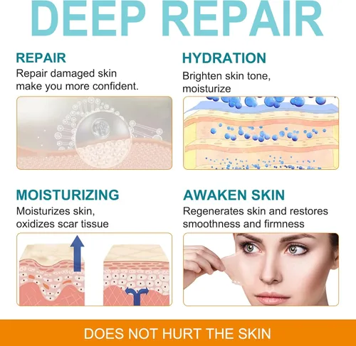 Vista 2 de Hojas de silicona para cicatrices (1.6 x 150 pulgadas - 3.8 M), cinta de silicona suave de grado médico, tiras de cicatrices, rollo de cicatrices