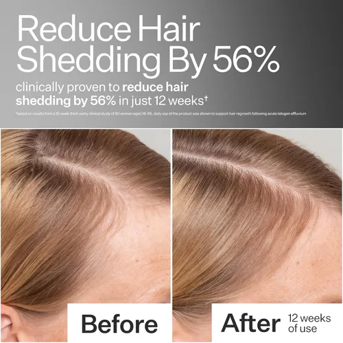 Vista 2 de Act+Acre - Suero de células madre procesadas en frío, para cabello más grueso y de aspecto más completo, células madre de manzana, extracto