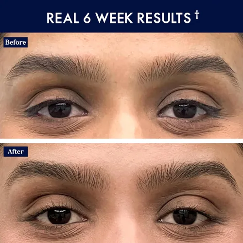 Vista 4 de SugarbearPRO BrowCare - Suero vitamínico con péptidos MSM y biotina Fórmula vegana Suministro de 3 meses para cejas de aspecto más completo