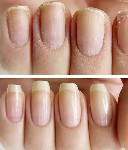 Vista 4 de NAILVIVE - Suero de uñas potentes proteínas de seda mágicas, fórmula natural probada que fortalece las uñas al instante evita que se rompan